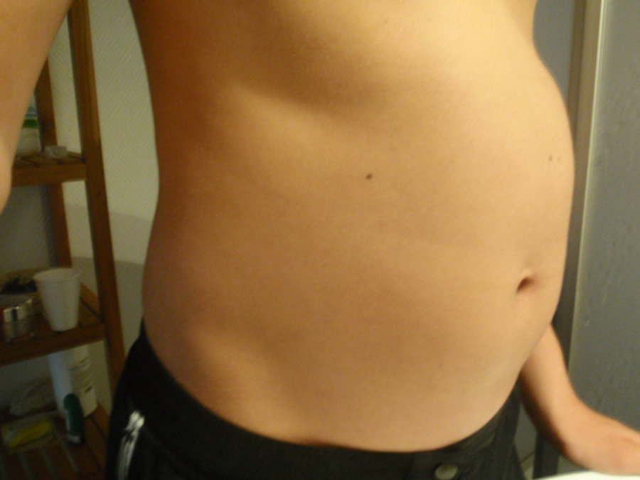 Tips To Cure Abdominal Bloating 2 Youth Village Nigeria
